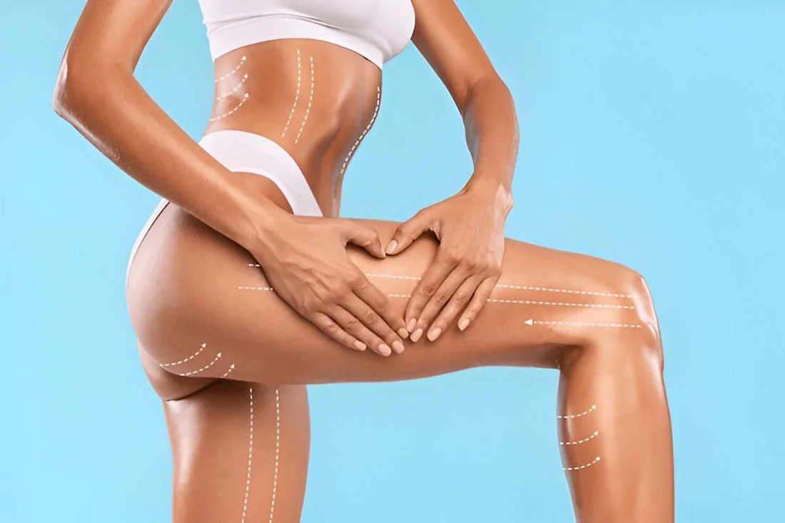 weight loss aims and management, fit lady